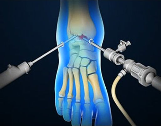 8db14c 5283474c3f5c412d8a750b32f8d0d0bdmv2