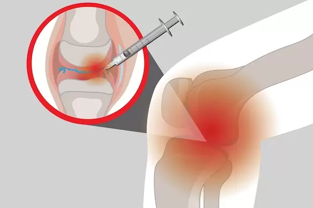 eklem enjeksiyonu levent