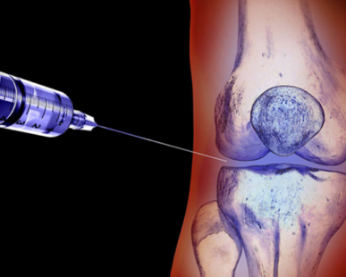 eklem ici enjeksiyon