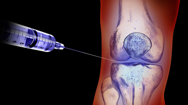 eklem ici enjeksiyon