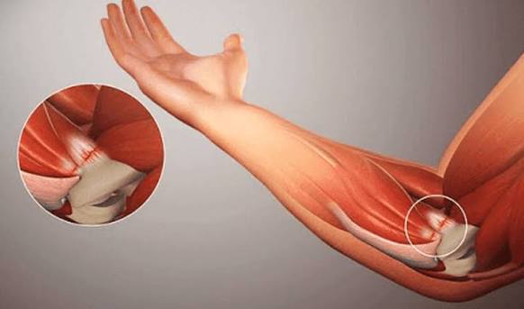 izmir-tendon
