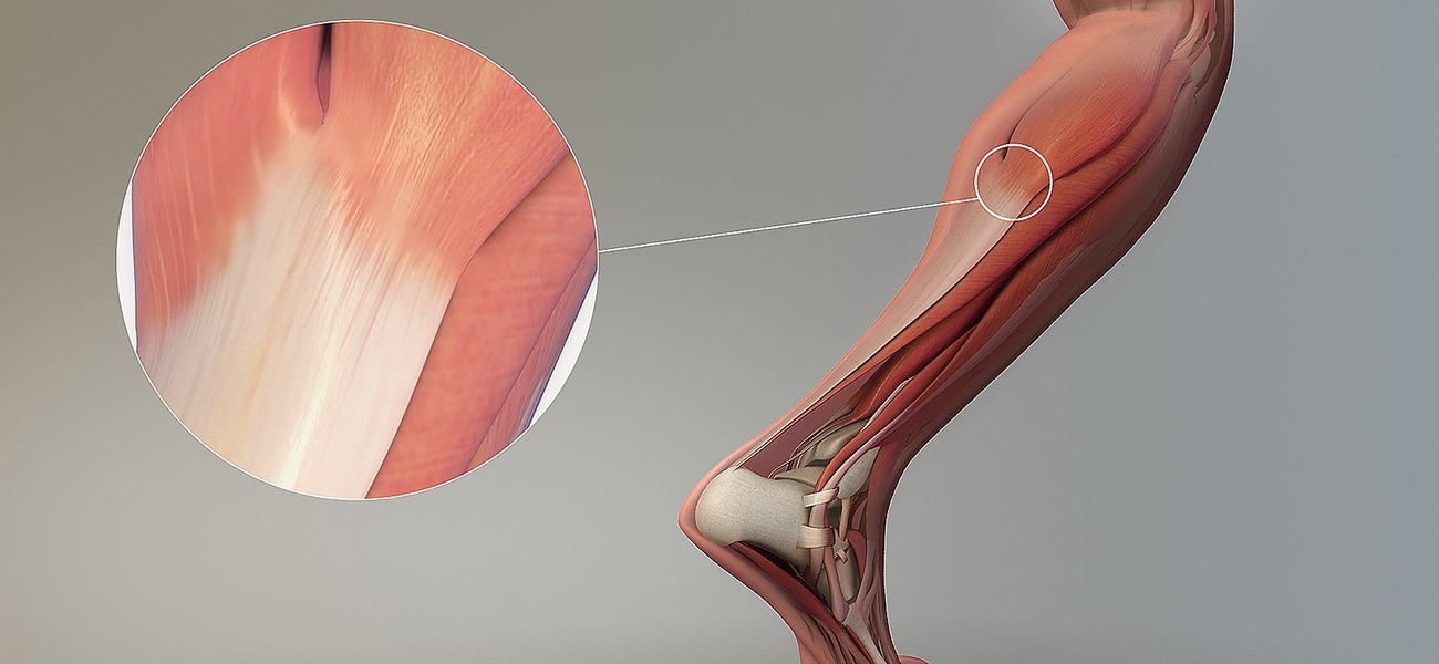 tendon nedir